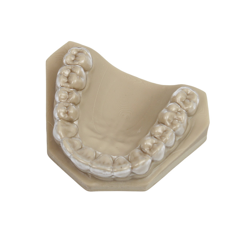 Essix Retainer - Image 2