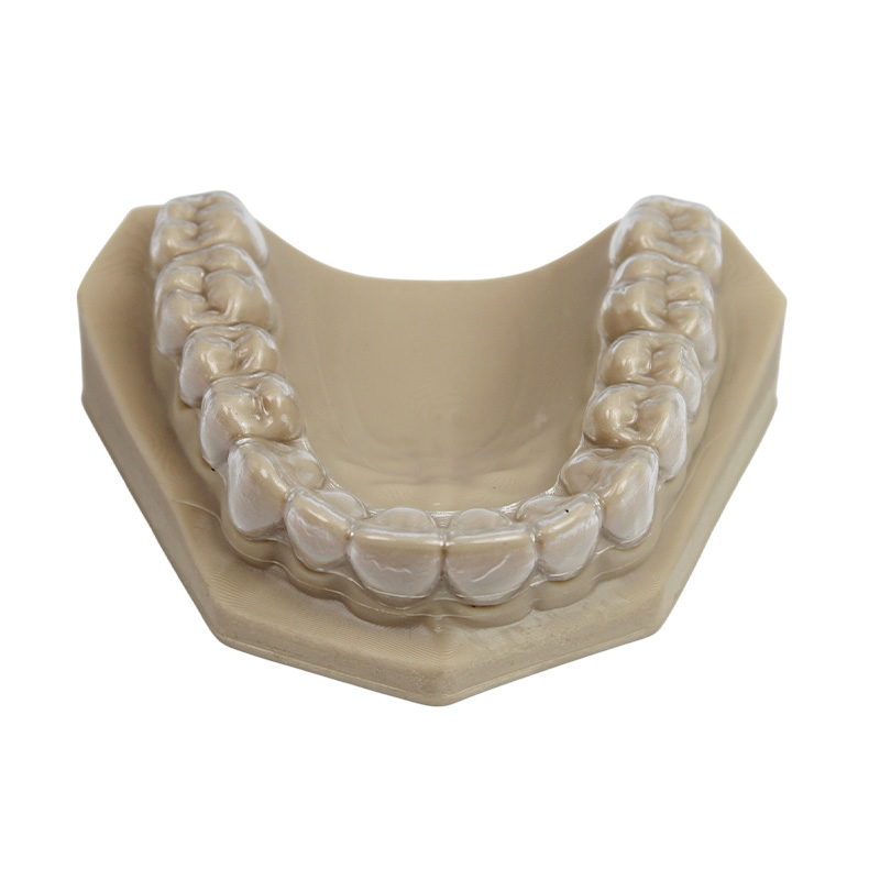 Essix Retainer - Image 3