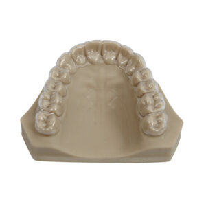 Essix Retainer