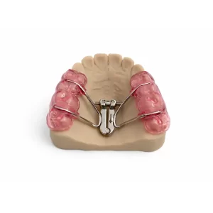 Bonded Fan Type (Upper Only)