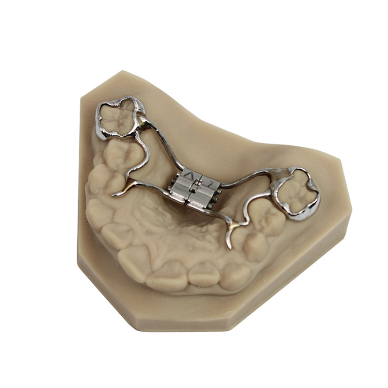 Rapid Palatal Expander - Image 2