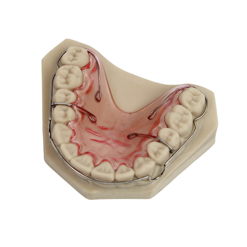 Wraparound Retainer - Image 2