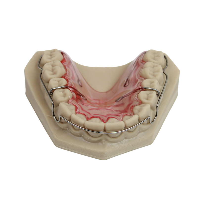 Wraparound Retainer - Image 3