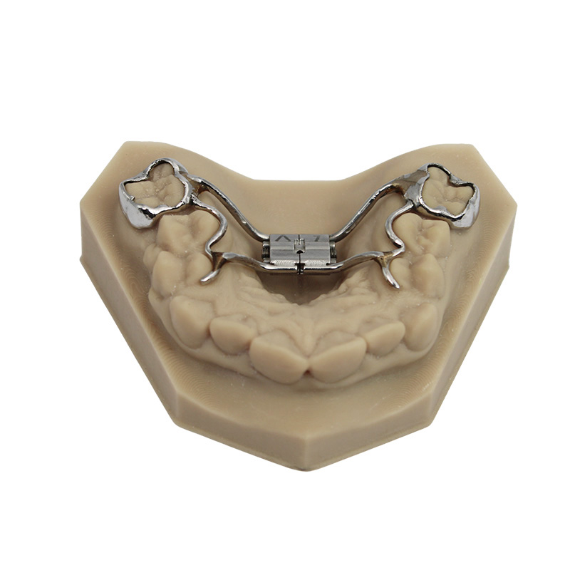 Rapid Palatal Expander - Image 3