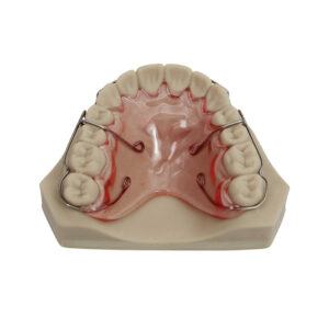 Wraparound Retainer
