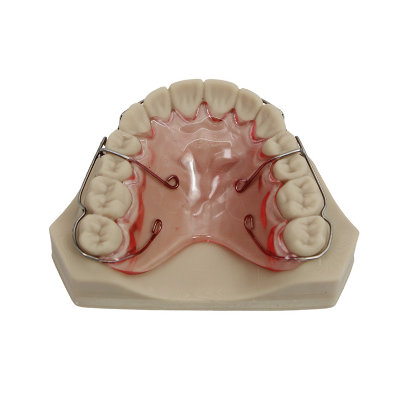 Wraparound Retainer