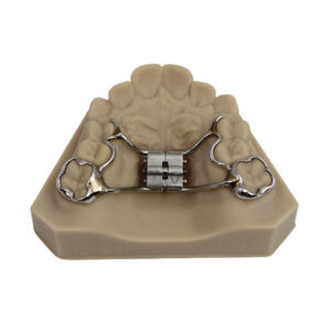 Rapid Palatal Expander
