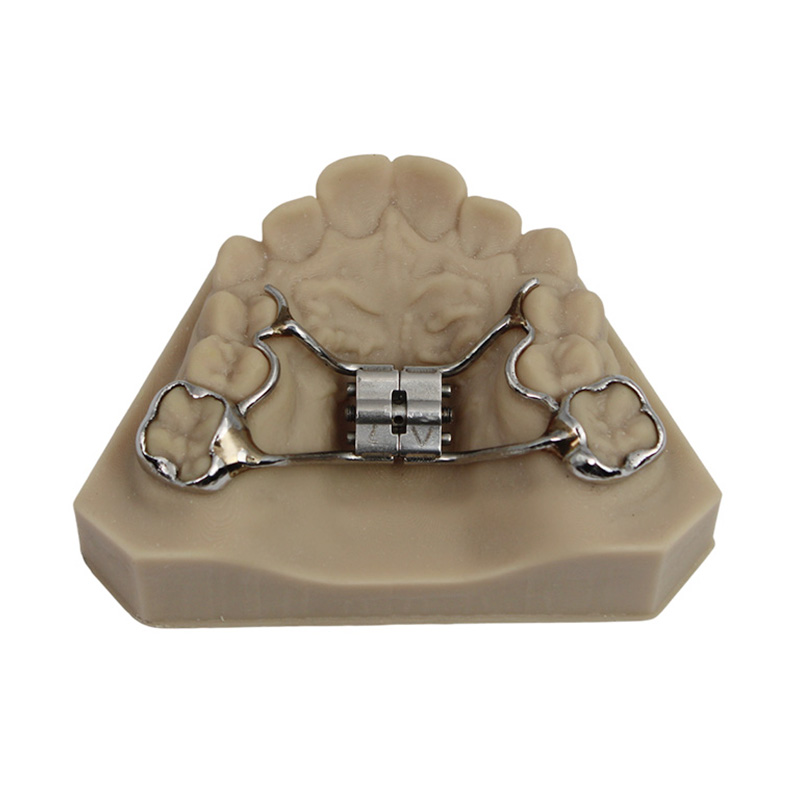 Rapid Palatal Expander