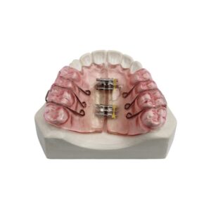 Removable Expansion Plate