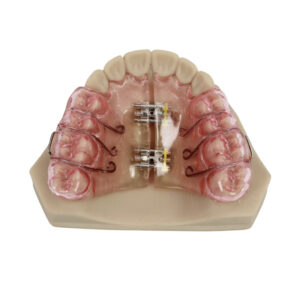 Removable Expansion Plate